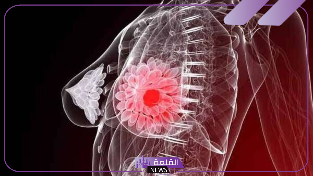 طريقة علاج هرمون الحليب بالقرآن الكريم.. أسباب ارتفاع هرمون الحليب طريقة علاج هرمون الحليب بالقرآن الكريم.. أسباب ارتفاع هرمون الحليب