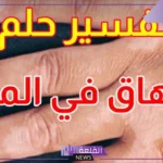 تفسير حلم الإصابة بمرض البهاق في المنام للعزباء للعصيمي