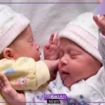 الحمل في توأم في كيسين منفصلين عالم حواء.. أعراض الحمل بتوأم من الأسبوع الأول