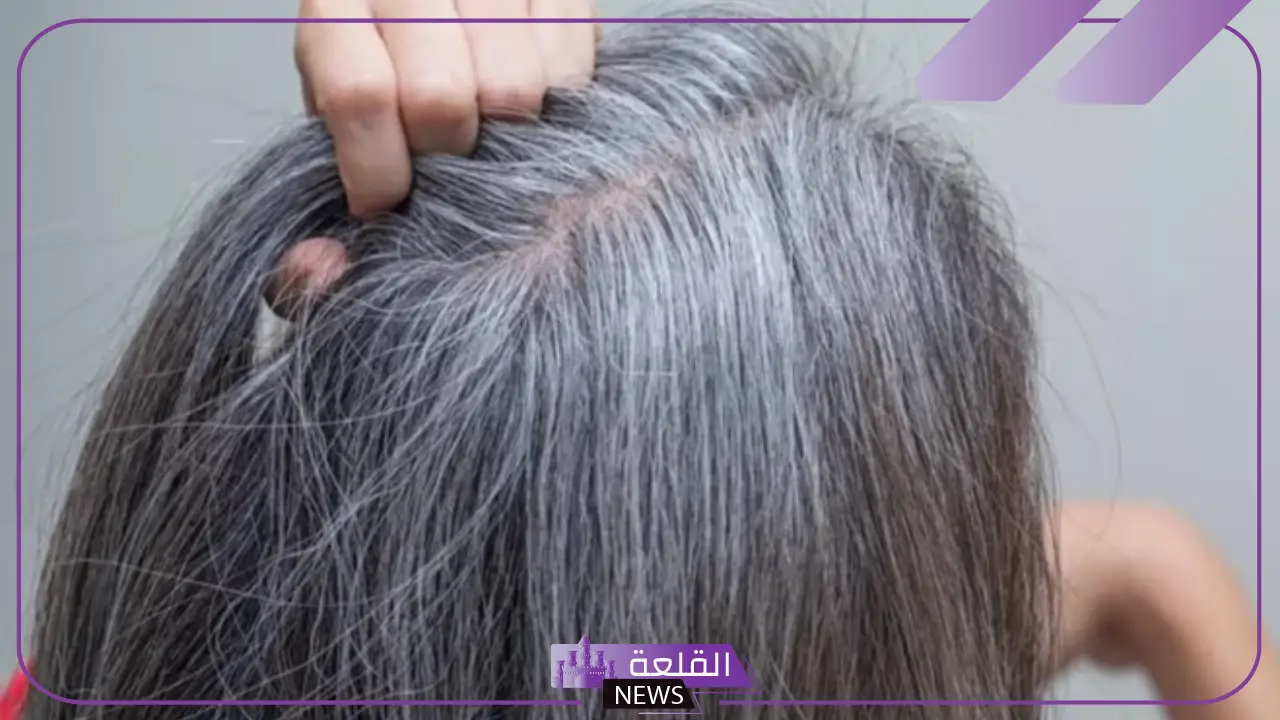 تفسير حلم الشعر الابيض في المنام للعزباء والمتزوجة لابن سيرين 5 شيب الشعر في المنام للعزباء