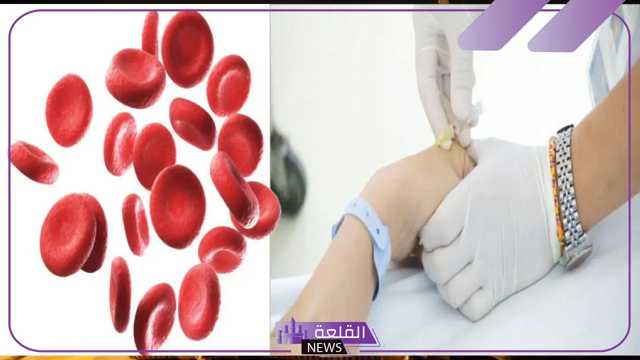 تجربتي مع الفصد وما الأمراض التي يعمل على علاجها؟ 5 ما هي الأمراض التي يعمل الفصد على علاجها