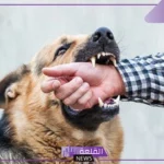 تفسير حلم عضة الكلب في المنام والشعور بالألم لابن سيرين