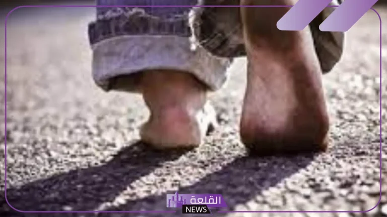 تفسير حلم المشي حافي في المنام للرجل والمرأة العزباء لابن سيرين