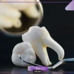 تفسير حلم خلع الضرس في المنام للمتزوجة والعزباء والحامل في المنام