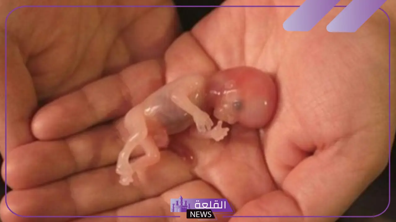 تفسير حلم الاجهاض للعزباء والمتزوجة والحامل في المنام لابن سيرين 5 معنى الإجهاض في الحلم للعزباء