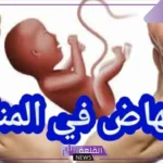 تفسير حلم الاجهاض للحامل والمطلقة والأرملة لابن سيرين 