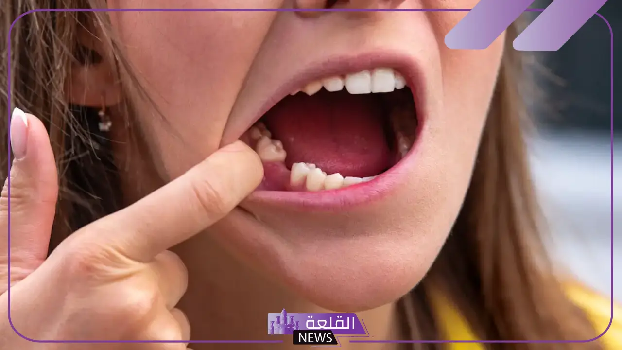 تفسير حلم ضرسي طاح نصه في المنام دون ألم للمرأة لابن سيرين 5 ضرسي طاح نصه