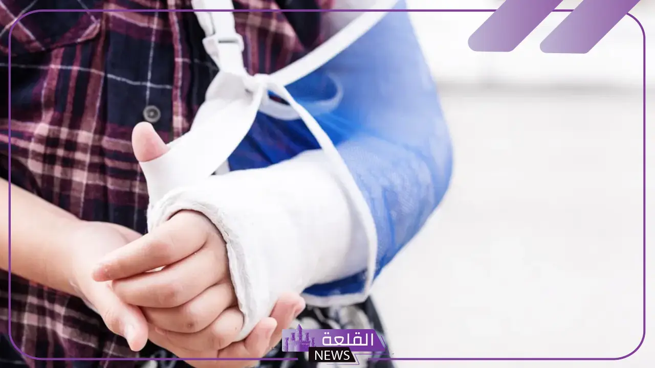 تفسير حلم كسر اليد في المنام للعزباء والمرأة المتزوجة 5 تفسير جبيرة اليد والجبس في المنام