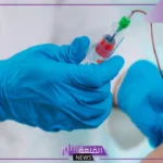 تجربتي مع الفصد وما الأمراض التي يعمل على علاجها؟
