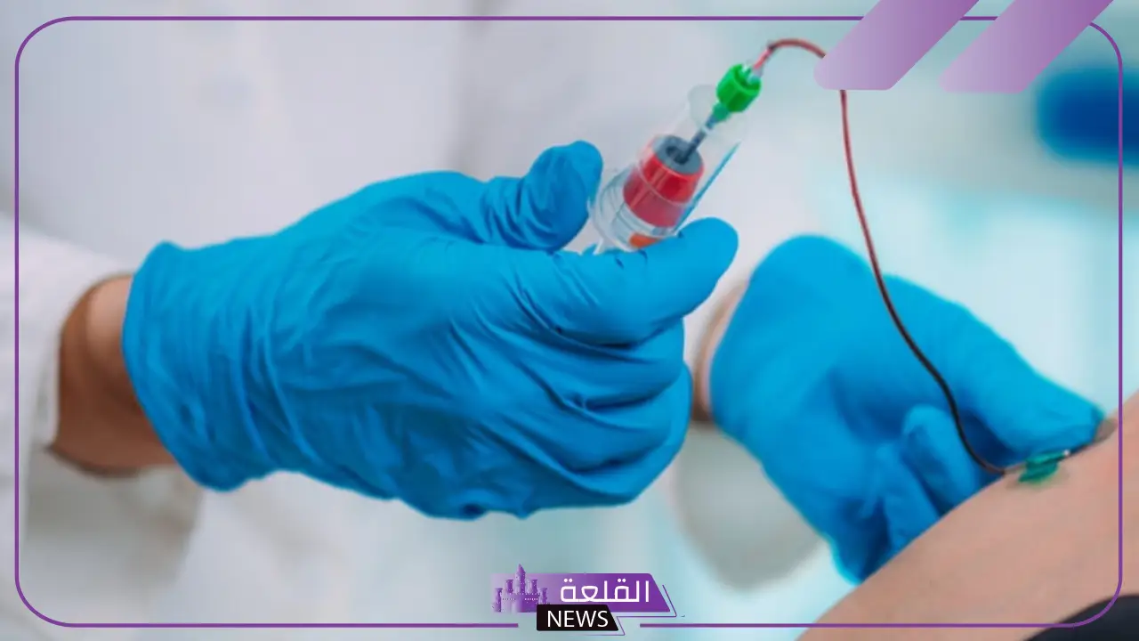 تجربتي مع الفصد وما الأمراض التي يعمل على علاجها؟