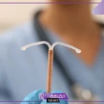 متى يسمح بالجماع بعد تركيب اللولب النحاسي عالم حواء