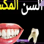 تفسير حلم السن المكسور في المنام للعزباء والرجل لابن سيرين