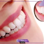 تفسير حلم الاسنان البيضاء في المنام لابن سيرين والنابلسي للعزباء