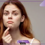 تفسير حلم حبوب حمراء في الوجه للمرأة والرجل لابن سيرين