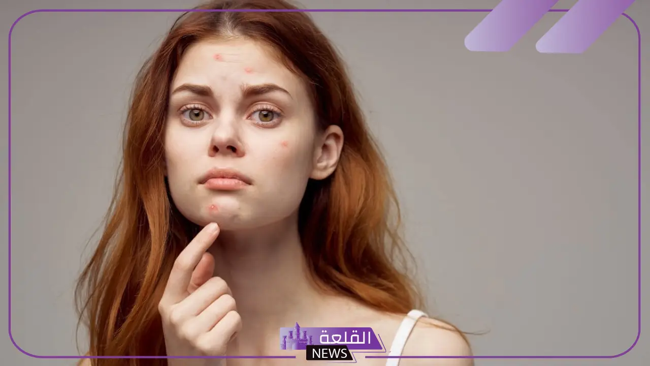 تفسير حلم حبوب حمراء في الوجه للمرأة والرجل لابن سيرين