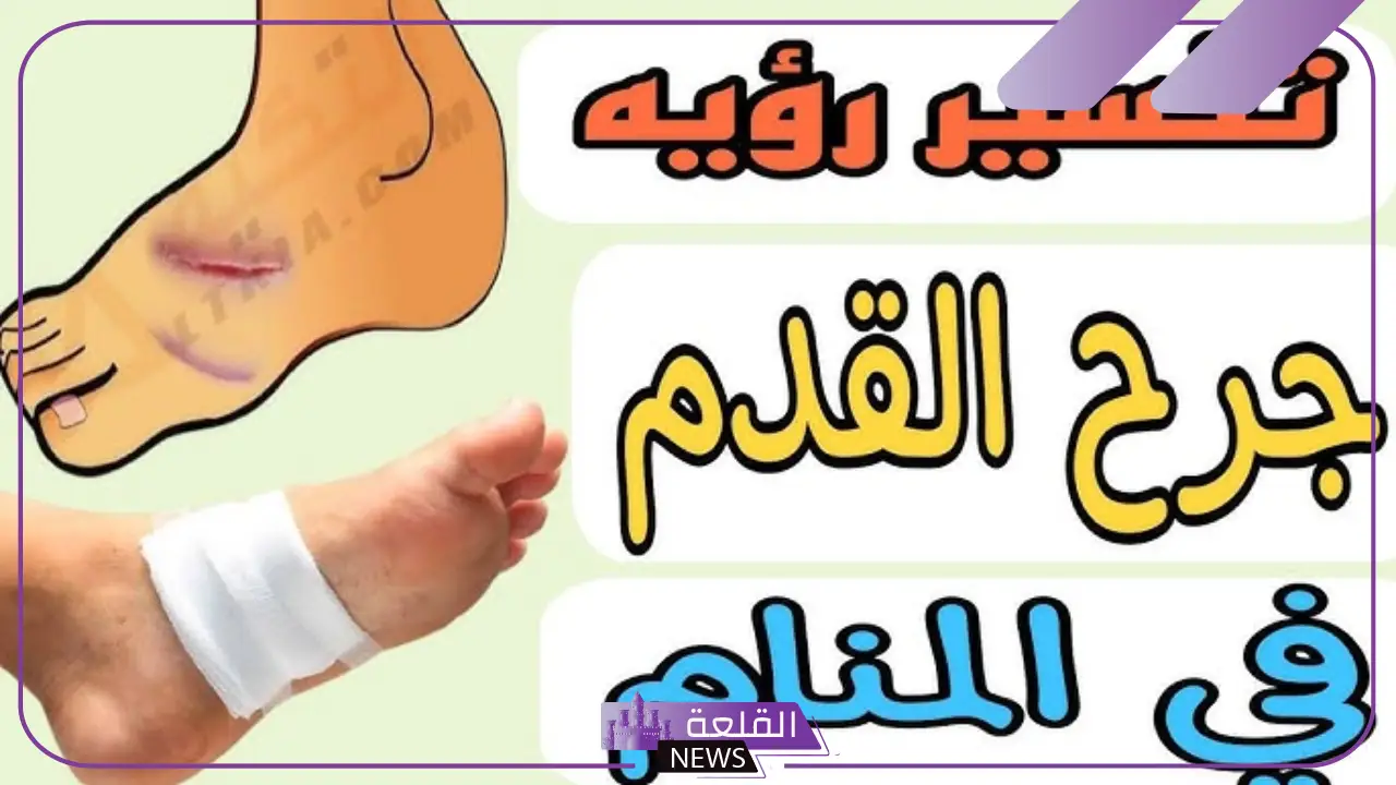 تفسير حلم الجرح في الرجل للرجل والمرأة وخروج الدم لابن سيرين