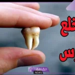 تفسير حلم خلع الضرس في المنام  للرجل والمرأه في المنام لابن شاهين