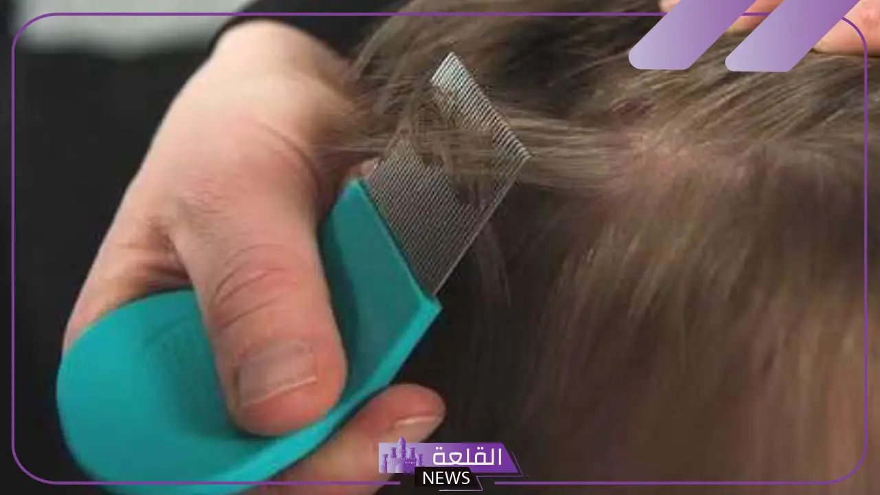 تفسير حلم رؤية القمل في المنام للمتزوجة والعزباء والمطلقة والرجل 6 تفسير حلم القمل في الشعر للحامل