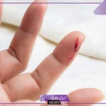 تفسير حلم رؤية قطع اليد في المنام للنفس ولشخص آخر لابن سيرين