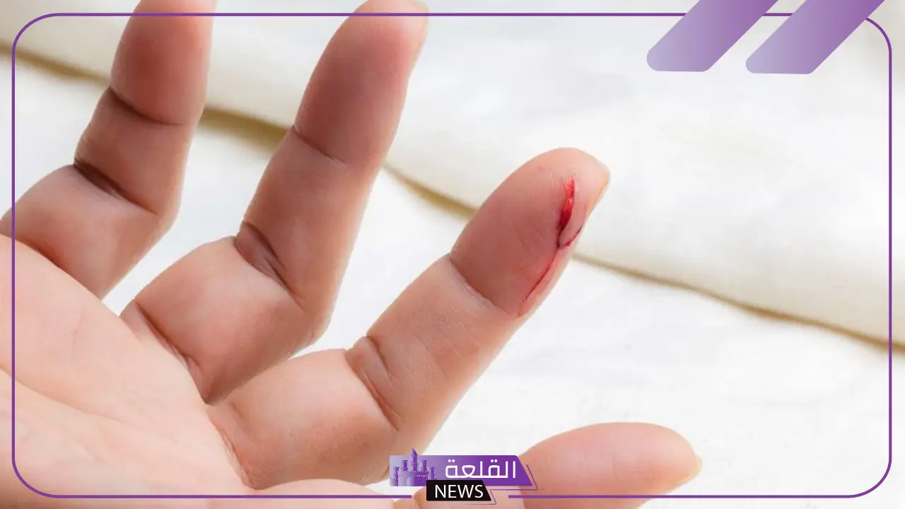 تفسير حلم رؤية قطع اليد في المنام للنفس ولشخص آخر لابن سيرين