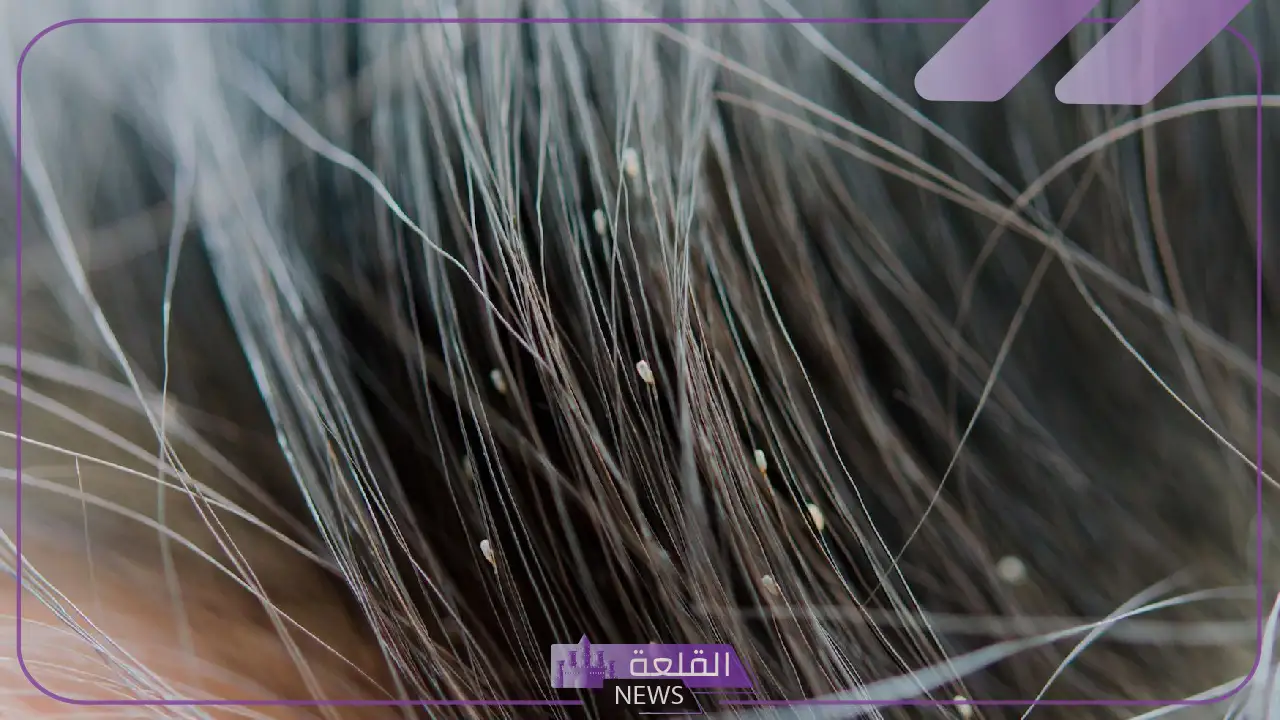 تفسير رؤية القمل في المنام لابن سيرين للعزباء والمتزوجة 5 رؤية القمل على الملابس للمتزوجة