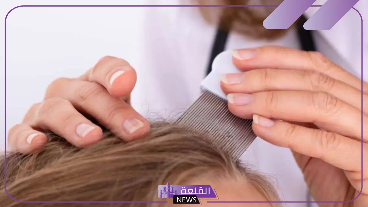 تفسير رؤية القمل في المنام للعزباء والمتزوجة في الشعر وقتله تفسير رؤية القمل في المنام للعزباء والمتزوجة في الشعر وقتله
