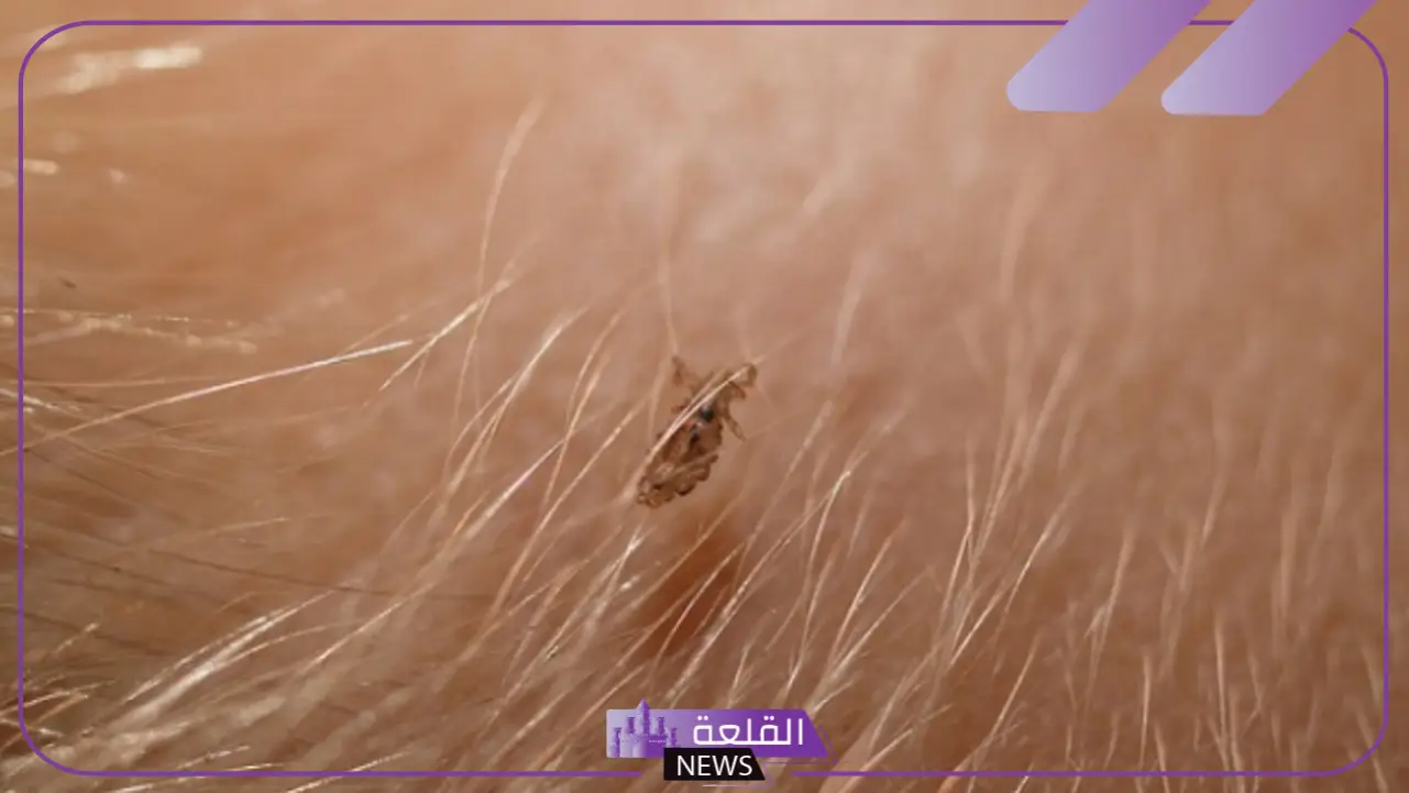 حلمت ان شعري فيه قمل في المنام للرجل والمرأة العزباء والمتزوجة