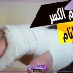 تفسير حلم كسر اليد في المنام ووضع جبيرة لابن سيرين