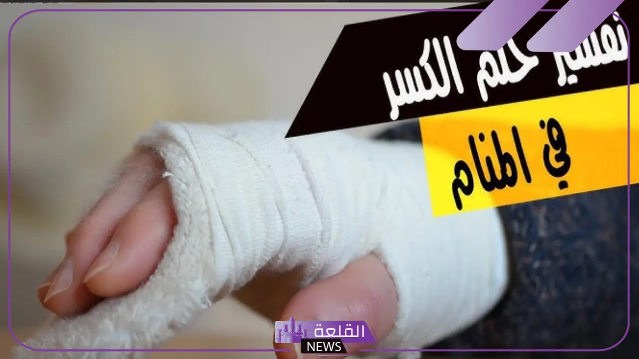 تفسير حلم كسر اليد في المنام ووضع جبيرة لابن سيرين