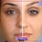  نصائح یومیة لتأخیر ظھور علامات التقدم في العمر حول العینین