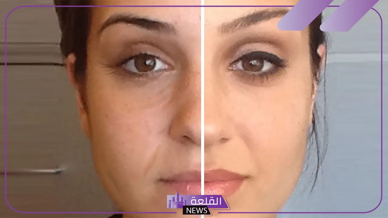  نصائح یومیة لتأخیر ظھور علامات التقدم في العمر حول العینین