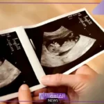 شكل الجنين في الشهر الثالث بالسونار.. أين يتركز الجنين الذكر؟