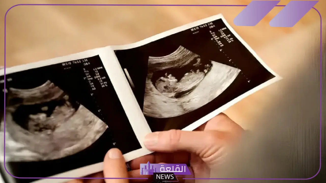 شكل الجنين في الشهر الثالث بالسونار.. أين يتركز الجنين الذكر؟