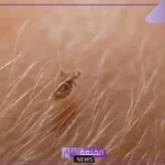 تفسير حلم القمل في المنام في الشعر للعزباء والمتزوجة لابن سيرين
