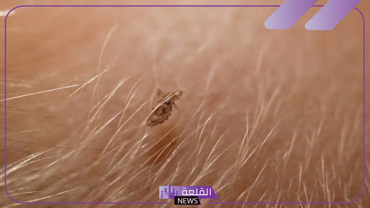 تفسير حلم القمل في المنام في الشعر للعزباء والمتزوجة لابن سيرين