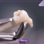 تفسير رؤية حلم خلع الاسنان في المنام عند العالم ابن سيرين