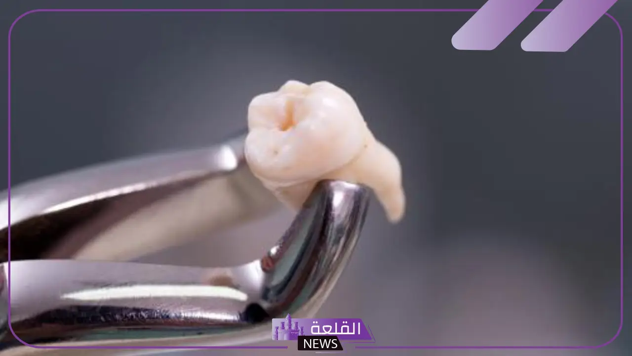 تفسير رؤية حلم خلع الاسنان في المنام عند العالم ابن سيرين
