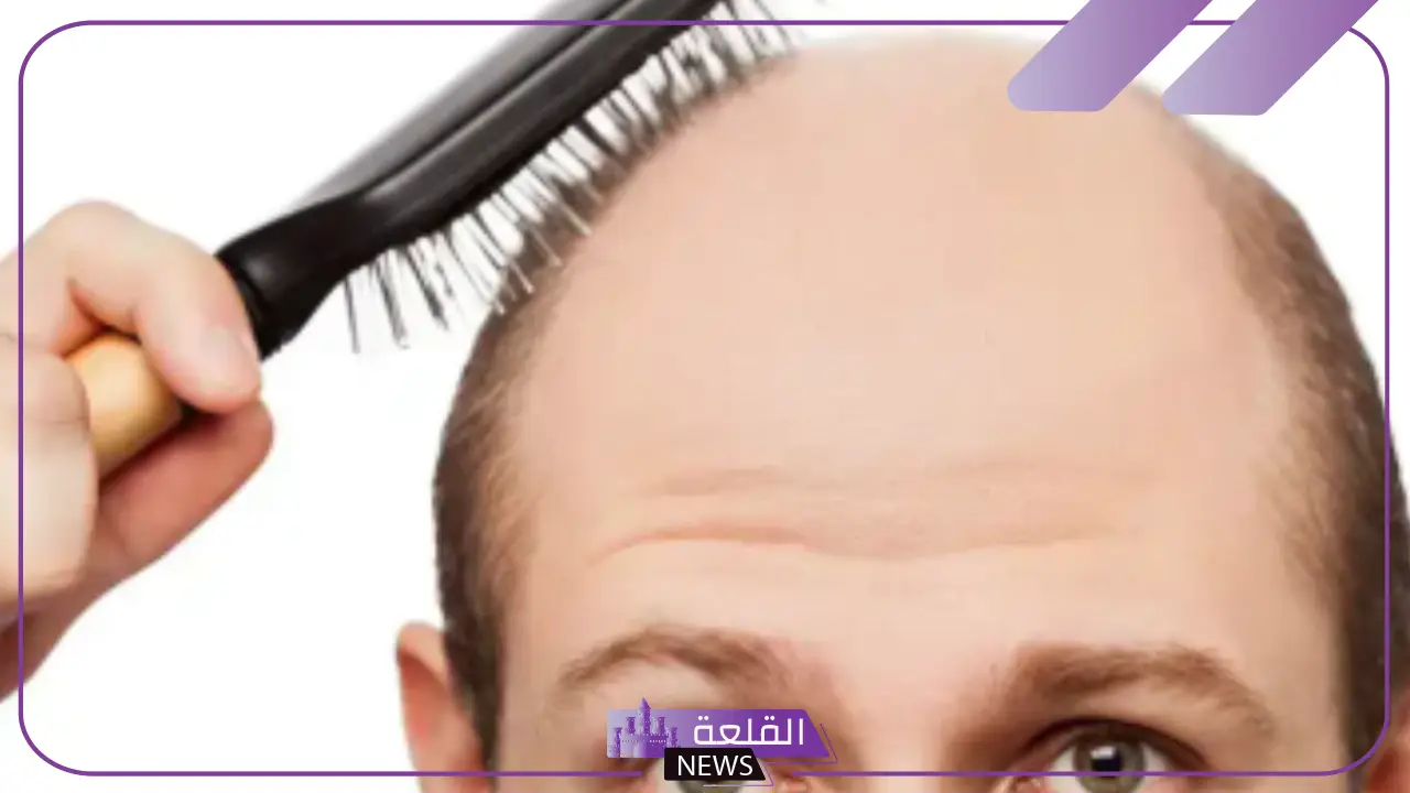 تفسير حلم الصلع للرجل المتزوج في المنام في جزء من الرأس