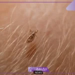 تفسير الحلم بالقمل في المنام للمتزوجة ورمز رؤيته لابن سيرين