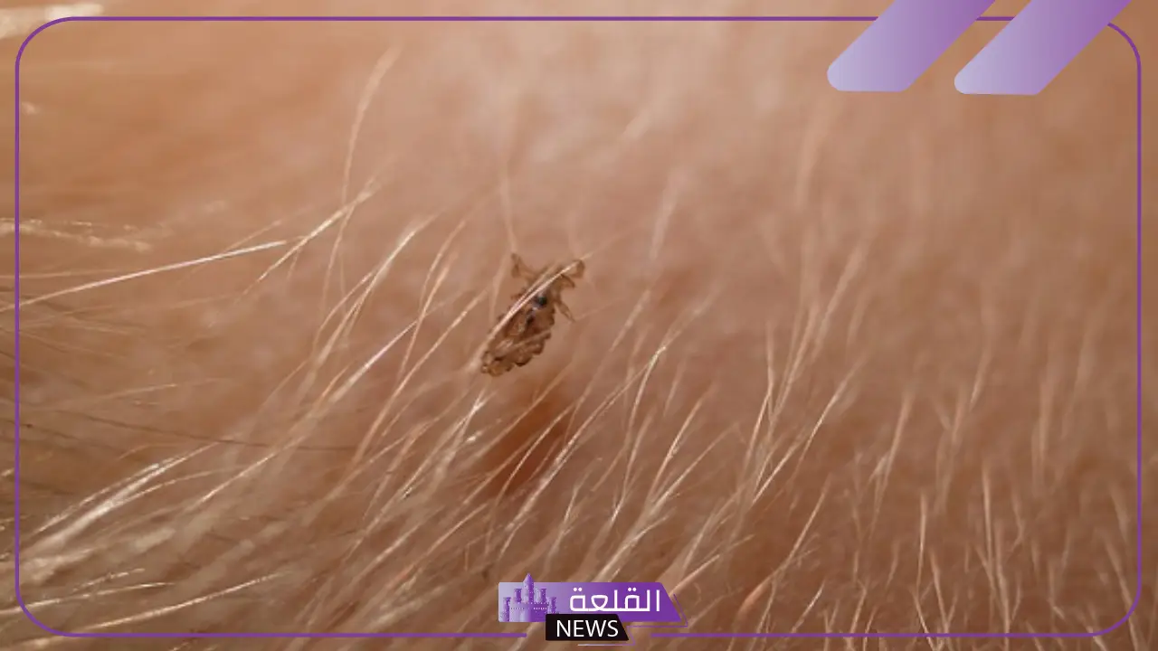 تفسير الحلم بالقمل في المنام للمتزوجة ورمز رؤيته لابن سيرين